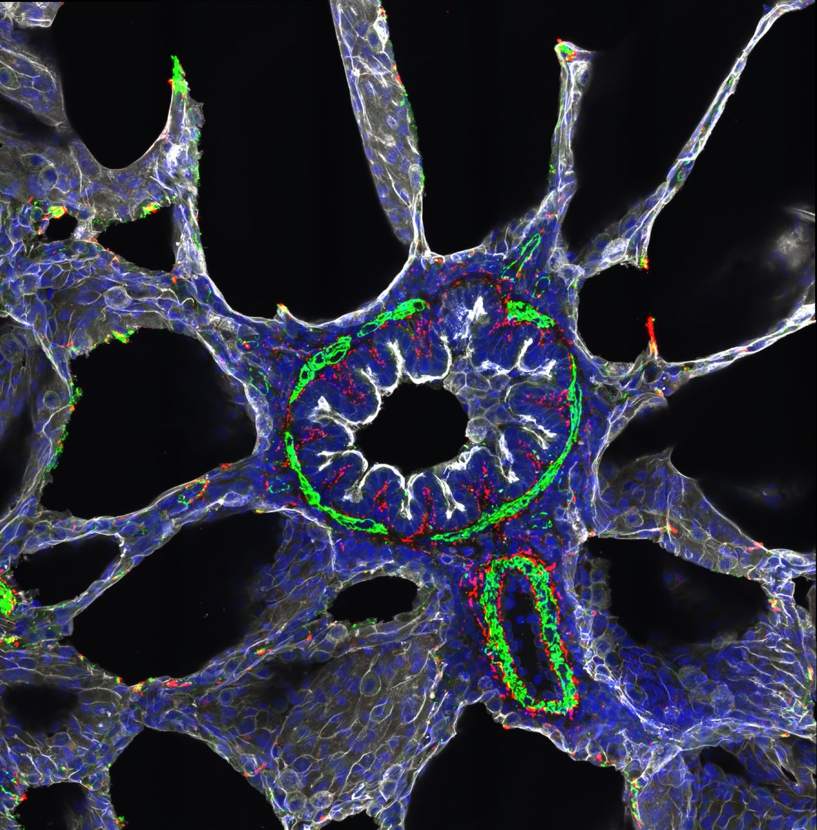 Lung Arachnid 🕷️🫁

Vivid acquisition of a small (&lt;50um) intrapulmonary airway with accompanying blood vessel, bordered by alveoli 🎈

#FluorescenceFriday #sciart #science #imaging #microscopy