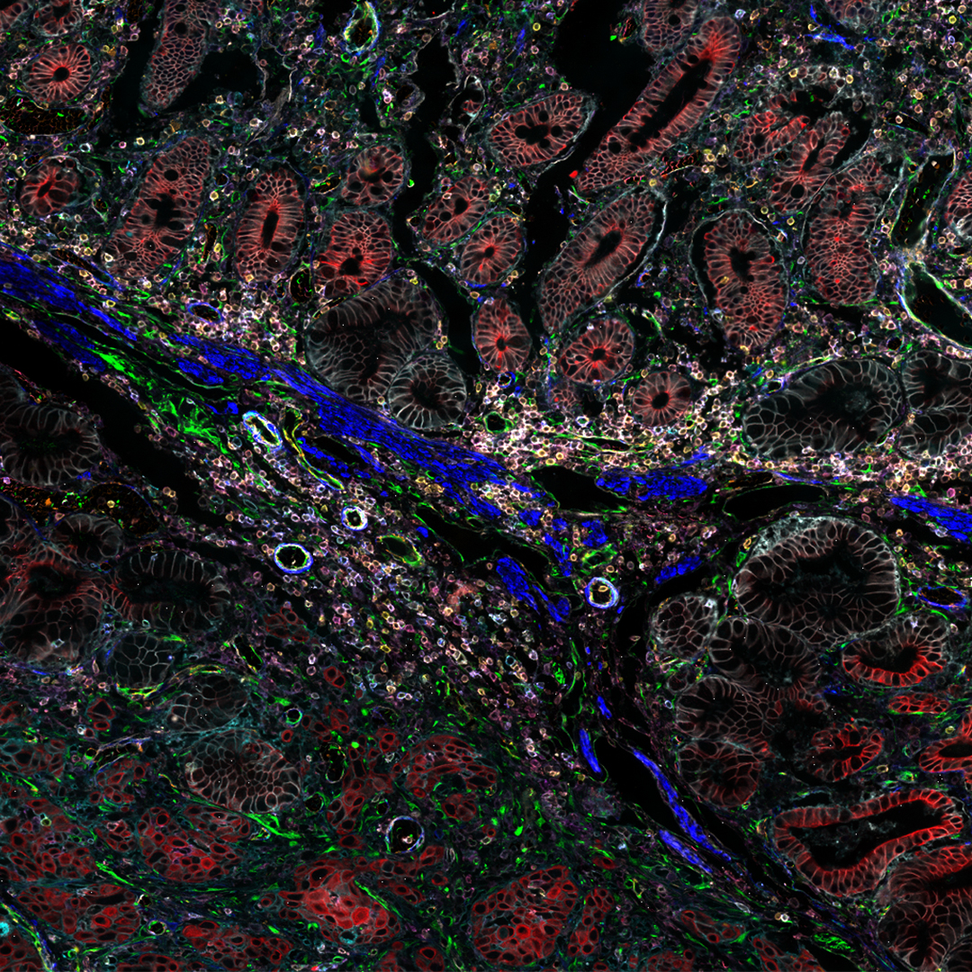 LeicaMicro's tweet photo. 🔶 Want to learn more about how #OpenMultiplexing is transforming tissue research?
🔶 Check out this webinar and discover how you can visualize 60+ biomarkers of your choosing on a single tissue sample with #CellDIVE.
👉 https://t.co/QjBiW7cmDL
#TissueResearch #cancer https://t.co/pVHi3AMnIn
