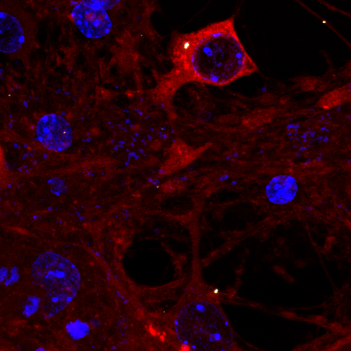 UKDRI's tweet photo. Super interesting study, led by @w_mcewan (UK DRI at Cambridge) reveals new insight into the mechanisms underlying an experimental antibody therapy for Alzheimer's🧠

The findings could pave the way for safer and more effective immunotherapy drugs👏👉https://t.co/UbmHpO2sdQ https://t.co/IKnDdRFOEl