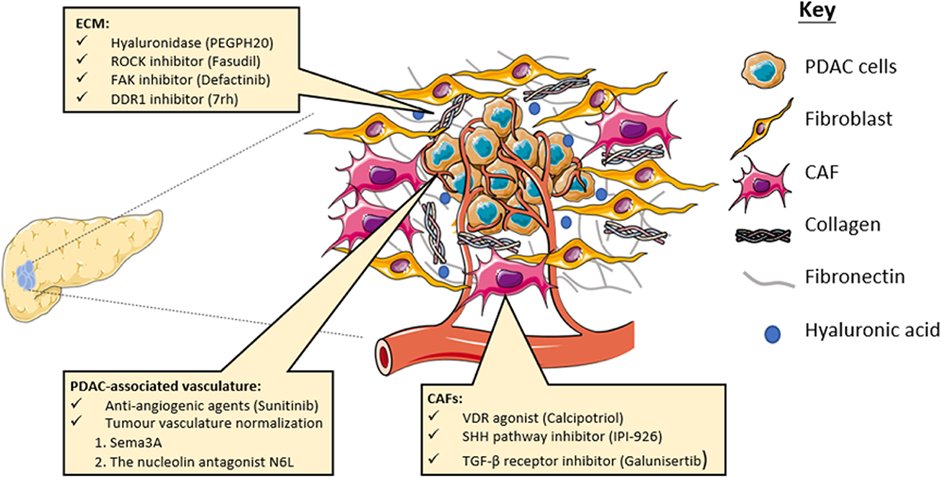 JPBY_official's tweet photo. Journal of Physiology and Biochemistry @JPBY_official
Stroma-targeting strategies in pancreatic cancer: a double-edged sword
@crcm_marseille #Pancreatic_cancer #Stroma #Therapy #Extracellular_matrix #Vasculature #Cancer_associated_fibroblasts
https://t.co/IxyzgfSrtQ https://t.co/9qc8GbuXA6
