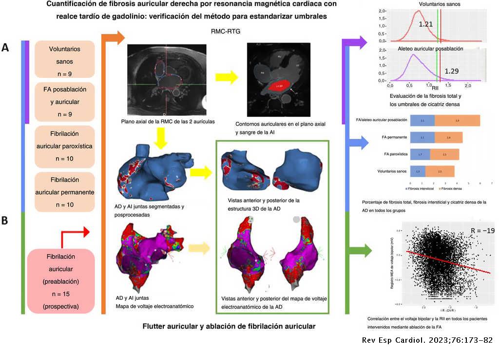 REC Publications (@revespcardiol) on Twitter photo Cuantificación de la fibrosis auricular derecha mediante resonancia magnética cardiaca: verificación del método para la estandarización de umbrales #REC <a href="/GunturizC/">ClaraGunturiz</a> <a href="/RWJE_BA/">Roger Borràs</a> <a href="/masitges/">marta sitges</a> <a href="/EduGuasch/">Eduard Guasch</a> <a href="/LluisMont2/">Lluís Mont</a>
revespcardiol.org//es-cuantifica…
📹Vídeo del editor revespcardiol.org/es-videos-fibr… Cuantificación de la fibrosis auricular derecha mediante resonancia magnética cardiaca: verificación del método para la estandarización de umbrales #REC <a href="/GunturizC/">ClaraGunturiz</a> <a href="/RWJE_BA/">Roger Borràs</a> <a href="/masitges/">marta sitges</a> <a href="/EduGuasch/">Eduard Guasch</a> <a href="/LluisMont2/">Lluís Mont</a>
revespcardiol.org//es-cuantifica…
📹Vídeo del editor revespcardiol.org/es-videos-fibr…