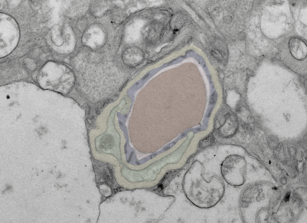 Giulia De Rossi 🔬👀🤯 (@gdr_tweets) on Twitter photo Very proud of my first TEM image 😍 - well, I only contributed the sample and the coloring skills, the image was taken by TEM master <a href="/BioBurgoyne/">Tom Burgoyne</a>.
Retinal capillary: Pericyte in green, EC in blue, BM in yellow and RBC in red.
#SciComm #eye #microscopy #STEM
#DiabeticRetinopathy Very proud of my first TEM image 😍 - well, I only contributed the sample and the coloring skills, the image was taken by TEM master <a href="/BioBurgoyne/">Tom Burgoyne</a>.
Retinal capillary: Pericyte in green, EC in blue, BM in yellow and RBC in red.
#SciComm #eye #microscopy #STEM
#DiabeticRetinopathy