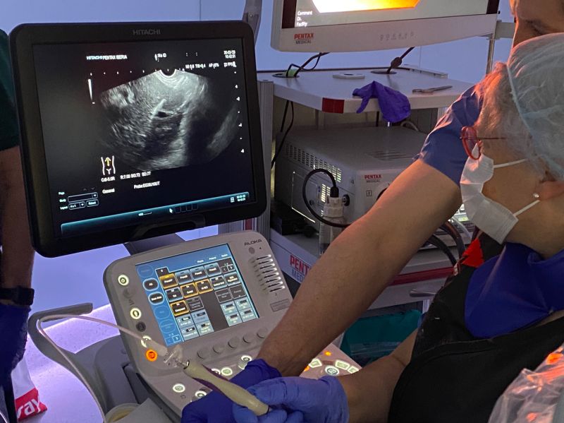CookMedSurg's tweet photo. Check out Cook's #EUS-guided portal pressure gradient measurement technology!
Photos from another successfully completed #EUSPPG case, this time from our team in Spain 👏 👏 #innovation #GiLiver https://t.co/prAjbSpxD7