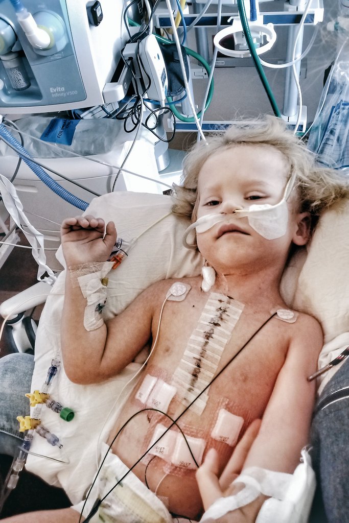 DobroWracaMG's tweet photo. ❗️BŁAGAM o RT🙏Musimy pilnie uzbierać 4 mln zł. Tyle kosztuje operacje serca ratującą życie w USA! Wojtuś ma 4 lata i 6 operacji serca za sobą. Teraz potrzebuje kolejnej - bez niej umrze! Mamy czas do czerwca. Zbiórka zwalnia a czas ucieka. Wesprzyj życie👉https://t.co/tcpauk7YUA https://t.co/6XBwXgS58C