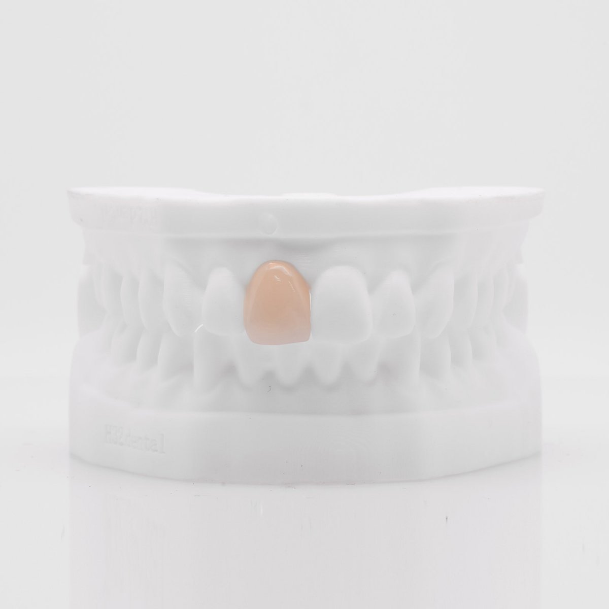 h32dental's tweet image. 💎 Couronne e.max CAD 💎 

Cette couronne en céramique renforcée est fabriquée avec la technologie de CFAO pour une précision et une qualité exceptionnelles.
#smilemaker #restaurationdentaire #emaxcad #dentisterie #dentisteriemoderne #technologiedentaire #pratiquedentaire