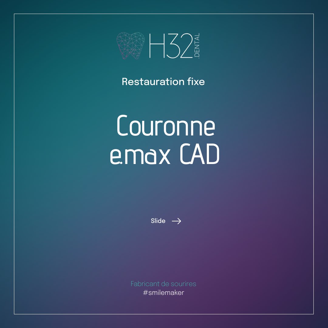 h32dental's tweet image. 💎 Couronne e.max CAD 💎 

Cette couronne en céramique renforcée est fabriquée avec la technologie de CFAO pour une précision et une qualité exceptionnelles.
#smilemaker #restaurationdentaire #emaxcad #dentisterie #dentisteriemoderne #technologiedentaire #pratiquedentaire