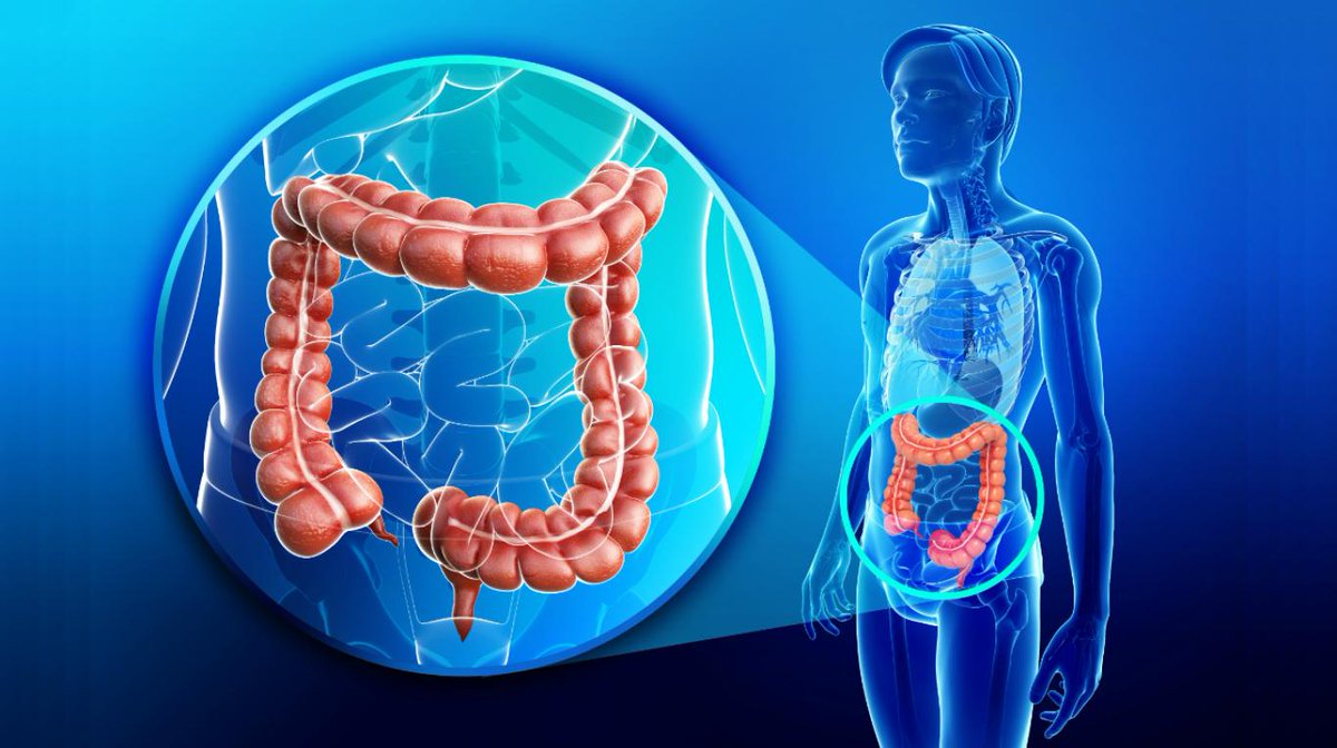 🔘 #Salud: DÍA MUNDIAL CONTRA EL CÁNCER DE COLON: CÓMO DETECTAR A TIEMPO ESTE ENEMIGO SILENCIOSO

Especialistas aconsejan mantener los chequeos preventivos al día y una alimentación equilibrada.

quintadimension.cl/2023/03/31/dia…