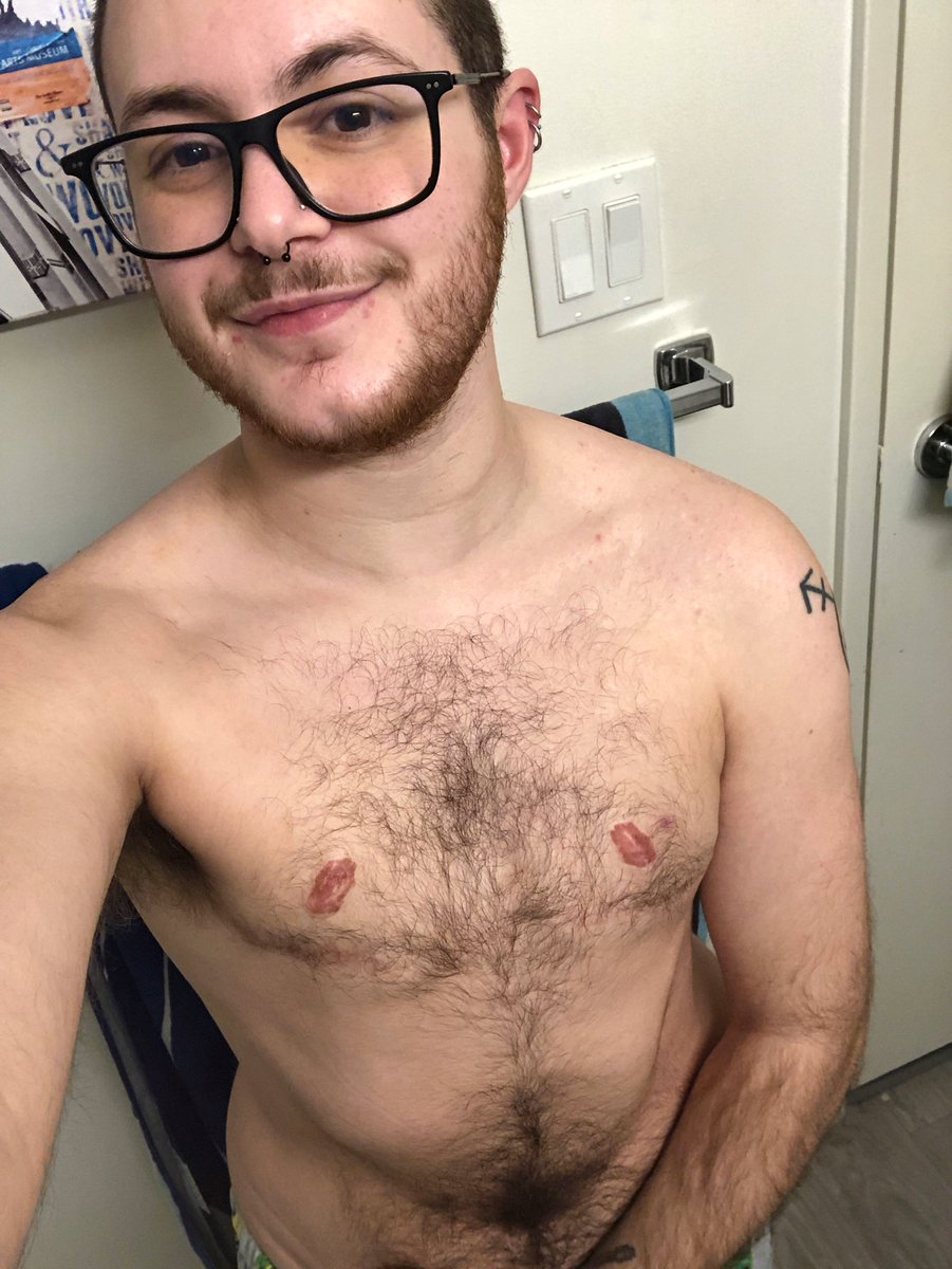 Kyle_Chronicles's tweet image. Happy #TransDayOfVisibility 🏳️‍⚧️

I love being a trans man &amp;amp; I love being able to experience so much joy in the body I exist in ☺️

No matter what anybody says, we have always &amp;amp; will always exist!

#TransDayOfVisibility2023