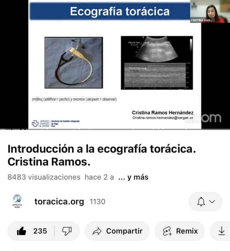 Necesitas saber un poco más de ecografía torácica? En nuestro canal puedes acceder a este vídeo de la Dra. Ramos. Mas de 8000 visualizaciones!! Link: youtu.be/fMyGuT6j0_Q