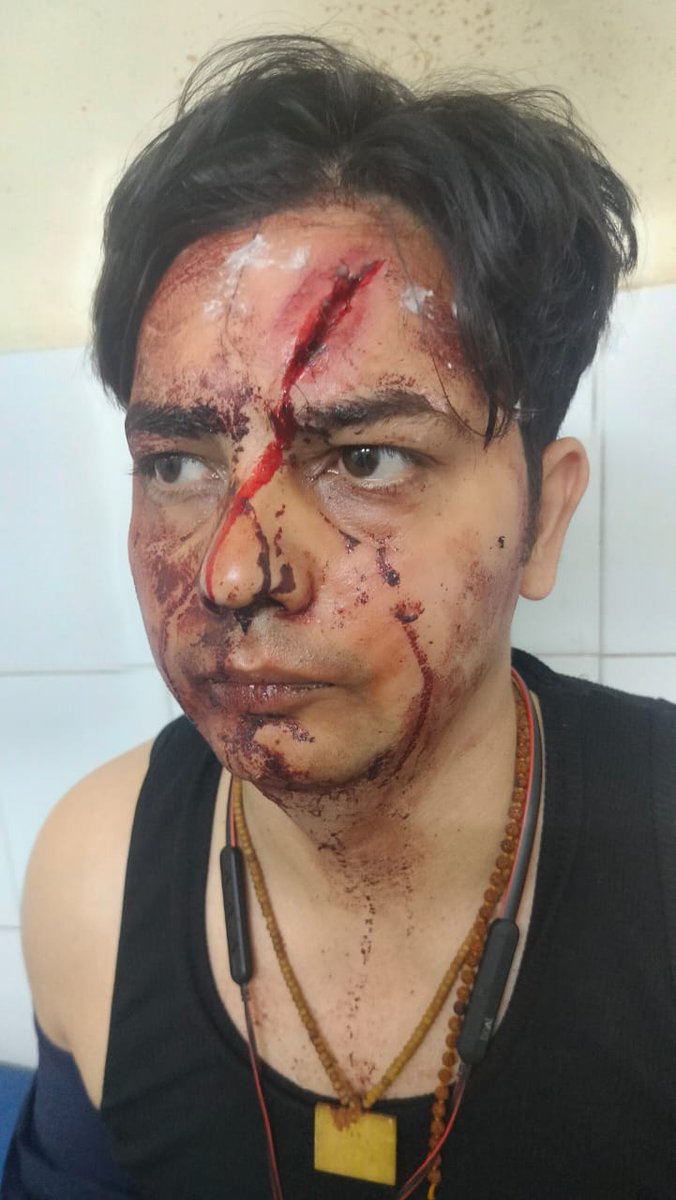 singhamit095's tweet photo. @TarunIdonneous @CMYogiAdityaNat @ghaziabadpolice @Uppolice @sspghaziabad2 @dm_ghaziabad इससे ये पता चलता है कि हमारी पुलिस और साथ ही हमारा समाज आज भी लचर है कुछ गुंडो के आगे, आशा है कि तरुण रस्तोगी जी को योगी जी के राज में न्याय मीलेगा! 🙏🙏 https://t.co/ckq0aNz0oI