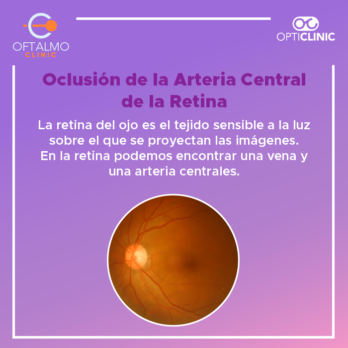 AVisionMetepec's tweet photo. ¿Sabes qué es la Oclusión de la Arteria Central de la Retina?🧐
Infórmate acerca de lo que este problema representa visitando nuestro blog en                                                                                  
🌐https://t.co/zR78ySuEWN

#YoSoyOftalmoclinic https://t.co/STJeRzrcDv