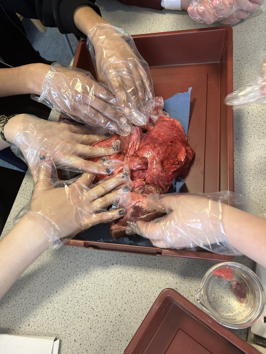 MissPaulBio's tweet photo. Heart and lung dissection with S1 to end the term🫀🫁 https://t.co/ncpq8NKMGc