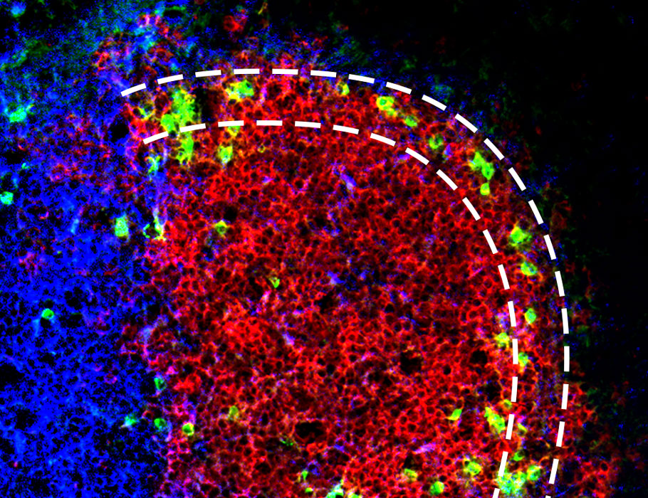 Science Immunology (@sciimmunology) on Twitter photo The compound celastrol from a Chinese medicinal herb called the thunder god vine effectively treats rheumatoid arthritis because it inhibits a relatively unexplored protein complex, finds new research from <a href="/osaka_univ_e/">The University of Osaka</a> #iFReC in mice. scim.ag/25F The compound celastrol from a Chinese medicinal herb called the thunder god vine effectively treats rheumatoid arthritis because it inhibits a relatively unexplored protein complex, finds new research from <a href="/osaka_univ_e/">The University of Osaka</a> #iFReC in mice. scim.ag/25F