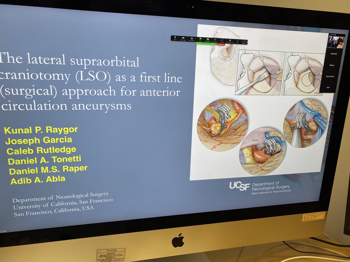 Big thanks to Dr. Adib Abla for giving UCSF NIR Professor Rounds about his surgical approach to treating aneurysms! @EricRSmithMD @RaghavMattay @amandaebaker @MattAmansMD @DrKazNIR @DowdCf