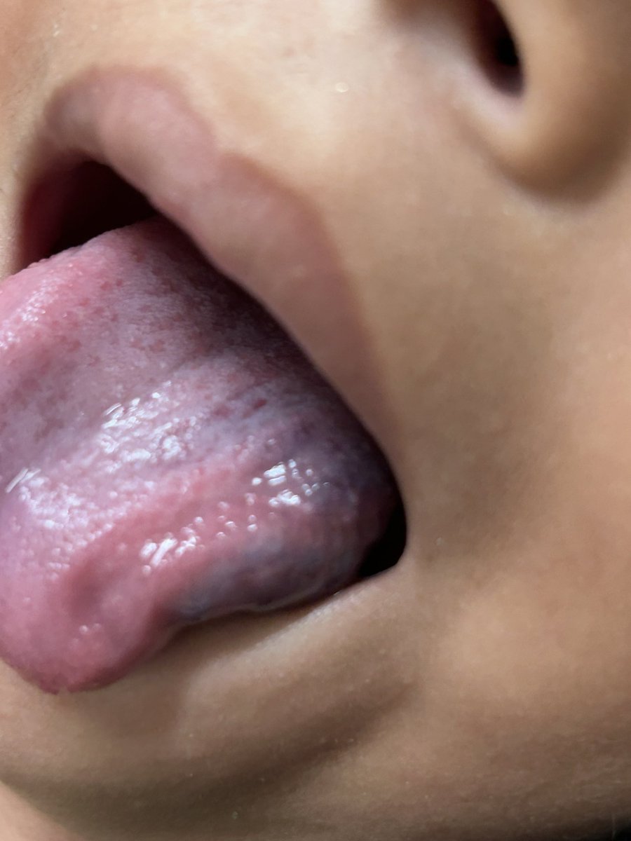 Dr. Dario Teplisky tweet media