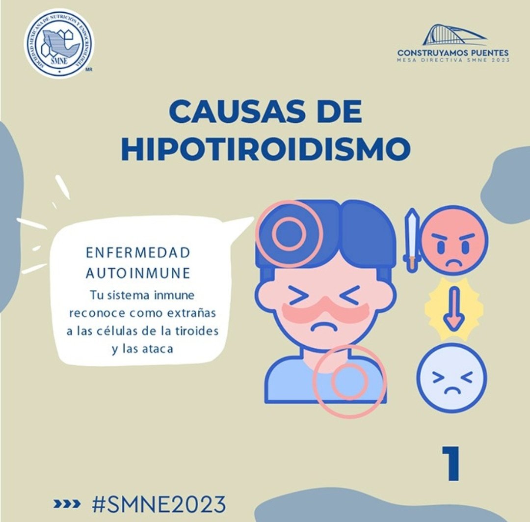 Iniciamos serie de visualización de problemas tiroideos, generado por el Grupo de Trabajo en Tiroides #GTT.
# SMNE2023
#ContruyamosPuentes 
#Tiroides.