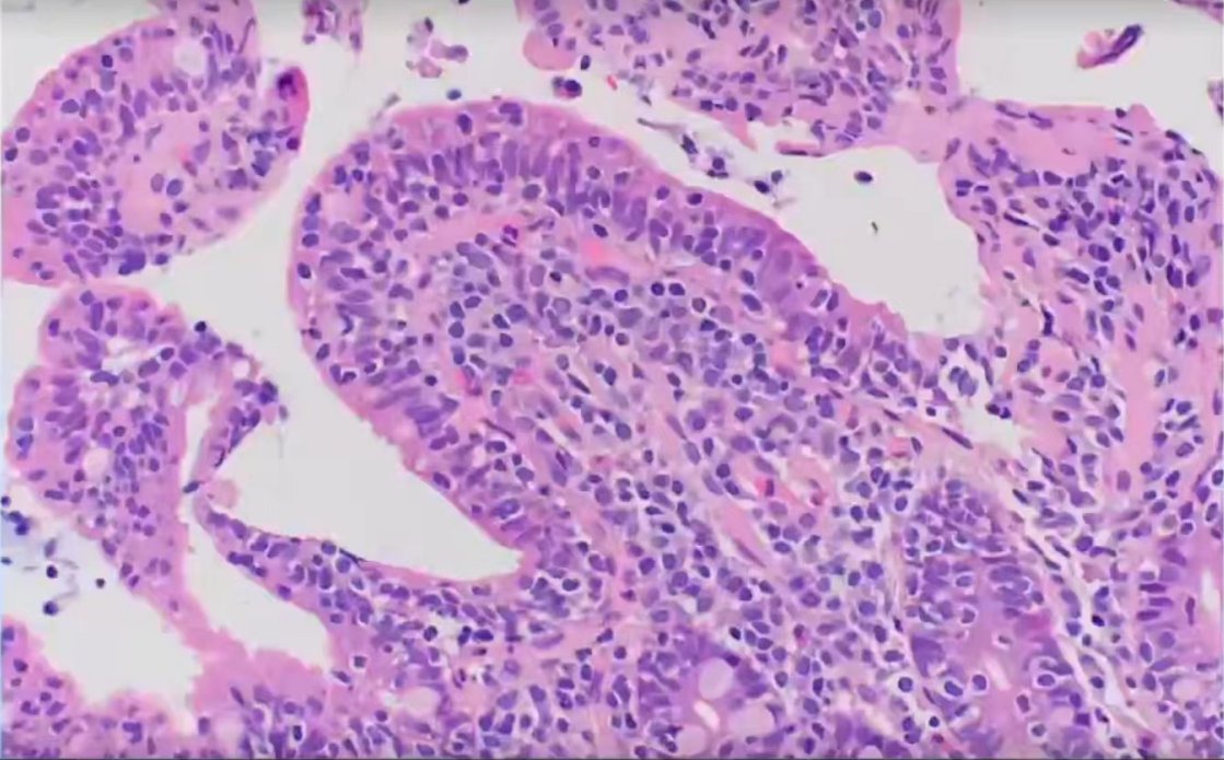 tiki_shi's tweet image. Today comes an octopus image 🐙 🐙 🐙

#digitalpathology
#digitalimaging