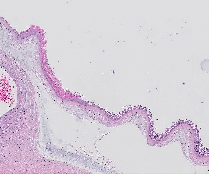 If you are an amnion, you can try to develop a thick skin but sometimes the s**t will get to you and you will react... #placentapath #pedipath #meconium