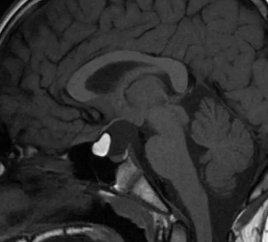 radRounds Radiology Network tweet media