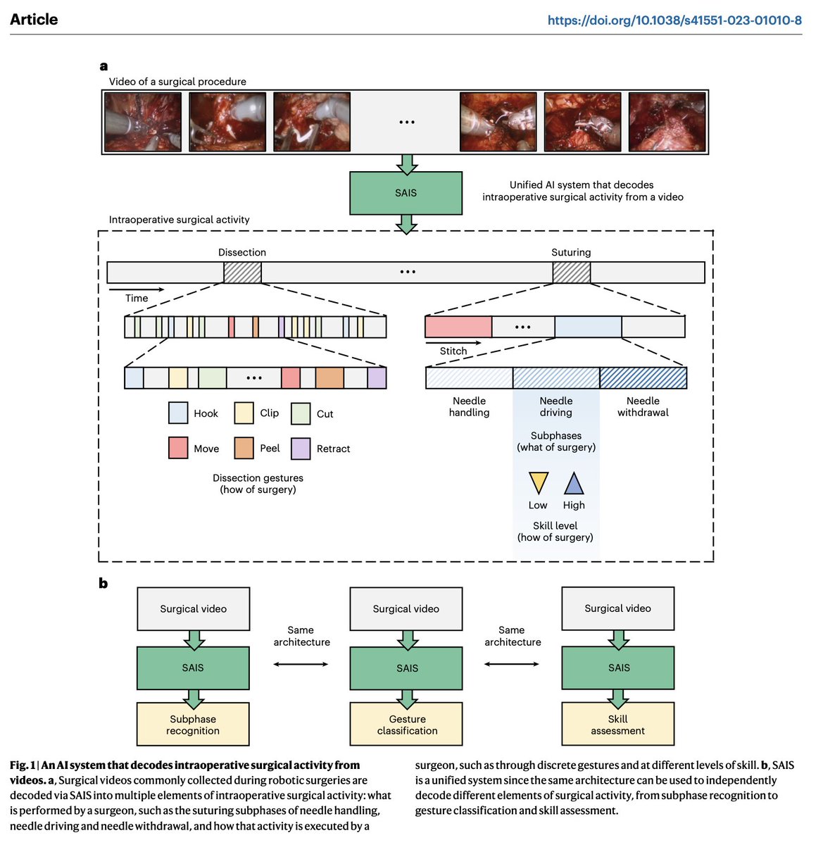 ddonoho's tweet image. Since coaches don&apos;t exist in the OR, surgeons receive less feedback than a 4th-grade basketball player. 

Can an AI system help surgeons improve?

In a three paper series just published 🔥 in @Nature_NPJ, we trained an AI to measure urologic surgery performance.

How did it do?