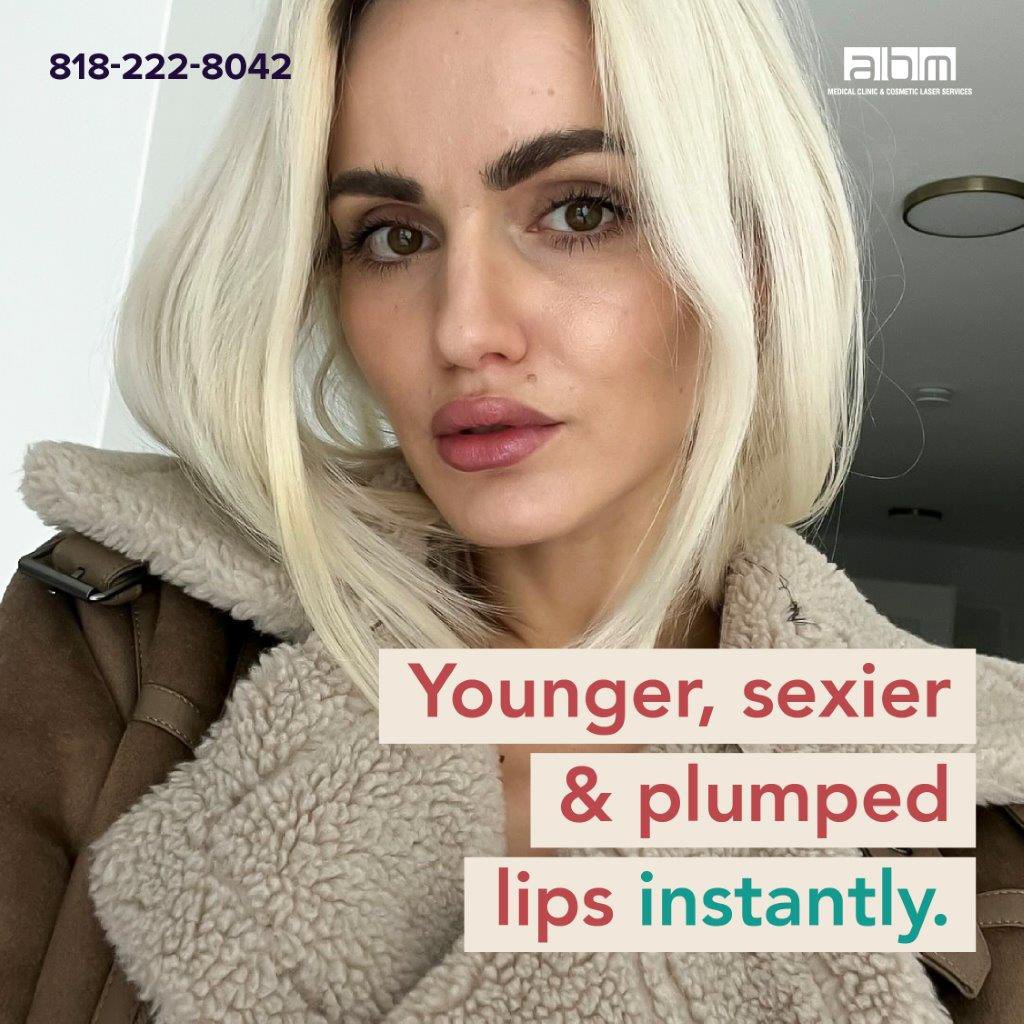 Younger sexier & plumped 🫶 lips cheeks and chin all in one quick visit with one of our doctors. ABM Medical clinic all of our treatments are performed by board certified physicians.  (818) 222-8042 #lipfiller #lips #cheekfiller #chinfiller #jawlinefiller