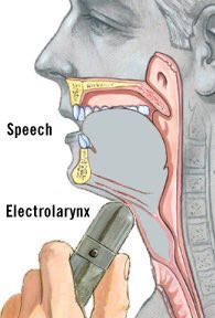 jonas_irl's tweet photo. @uglyhag69 @lefthandedranda it’s a vape https://t.co/xiXs5Twl9U