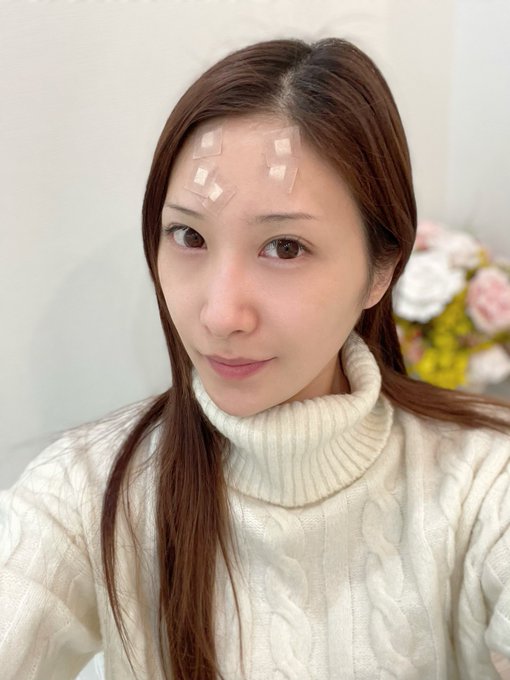 美容皮膚科で施術😆 激痛でした💦  今日はこのままで過ごしてくださいと指示を受けましたが、  キツいですね💧笑 午後は届いたDVDを観て気分を高めて...と思っていたのですけれど&hellip;泣  みなさま良い休日を過ごされてください✨