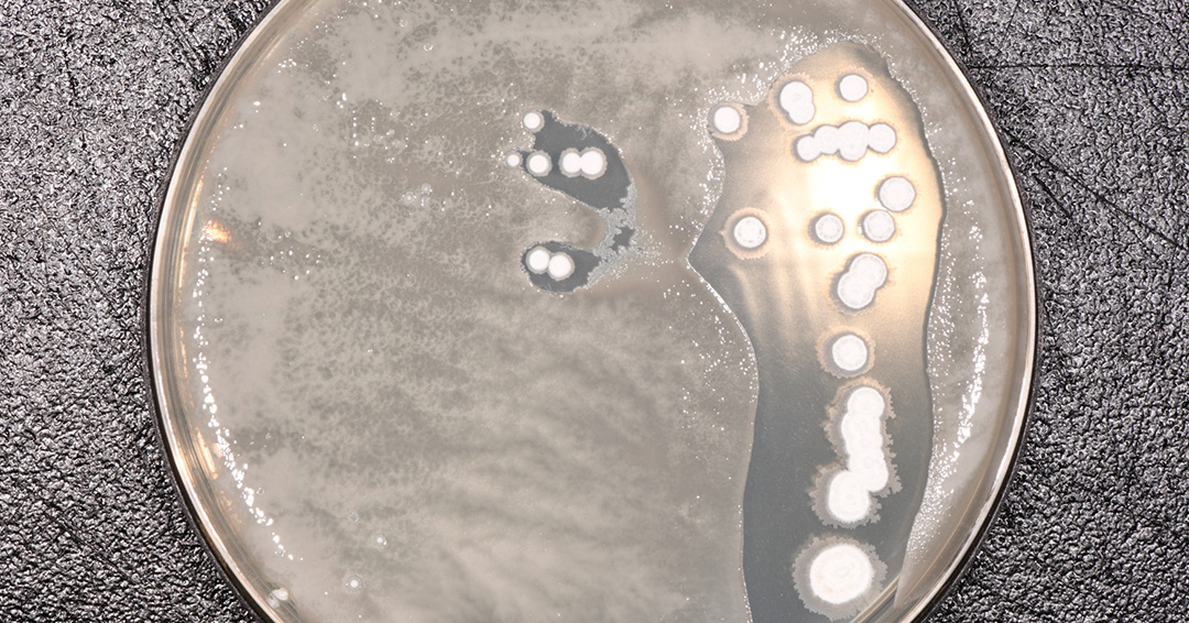 IMBatUQ's tweet photo. 2/3
The answer could be in your backyard! Microbes in your soil are in a constant battle over their territory and produce natural chemical interactions to fight for space. These interactions are where we can find new antibiotics!
#SoilsforScience #CitSciTC #CitSciMonth https://t.co/nw9oENchcD