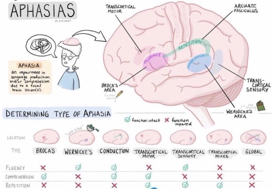 OGdukeneurosurg's tweet photo. How’s your knowledge of aphasias? Source M Stewart https://t.co/Ygz0lSuW77