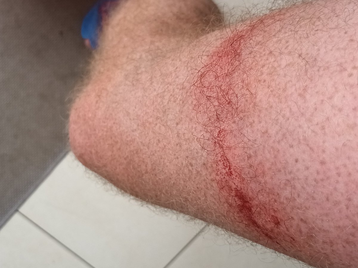 AndrewsPacian's tweet photo. The glamorous side of running 9.5m. Not chaffing, but discovered safety pins unopened in my pocket from last race day. https://t.co/GEHLLXHrR7