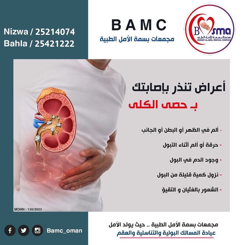 أعراض تنذر بإصابتك بحصى الكلى