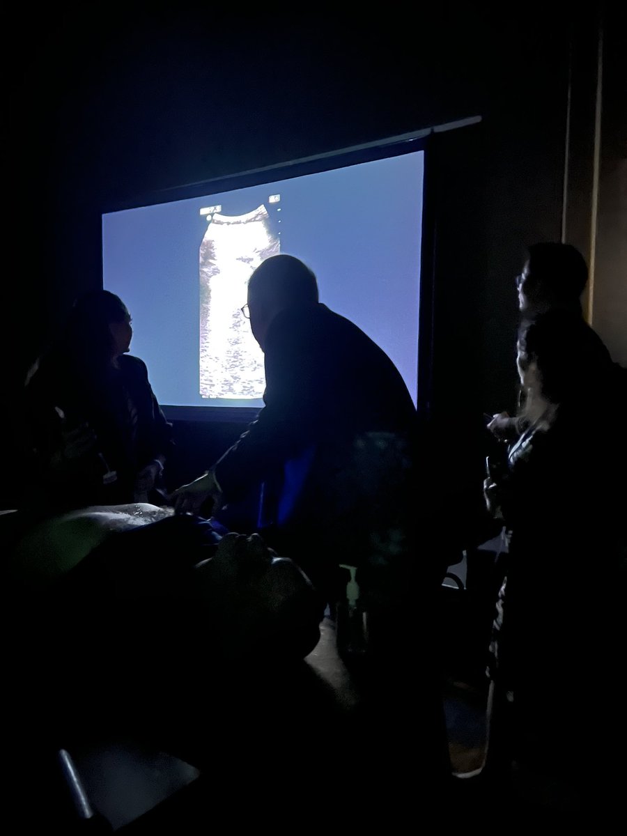 FOCUS on POCUS! It was such a joy to get share our excitement and practical methods for using POCUS for assessing fluid responsiveness in adults and children, including live demonstrations! @DrRonWald, @kianoushbk, #AKICRRT2023