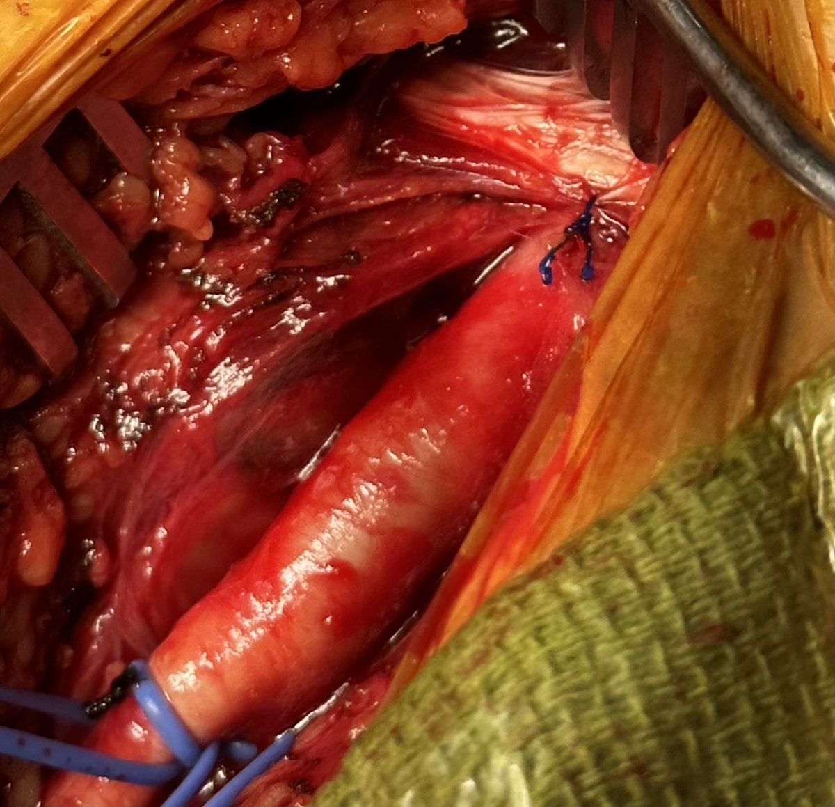 Donald Baril tweet media