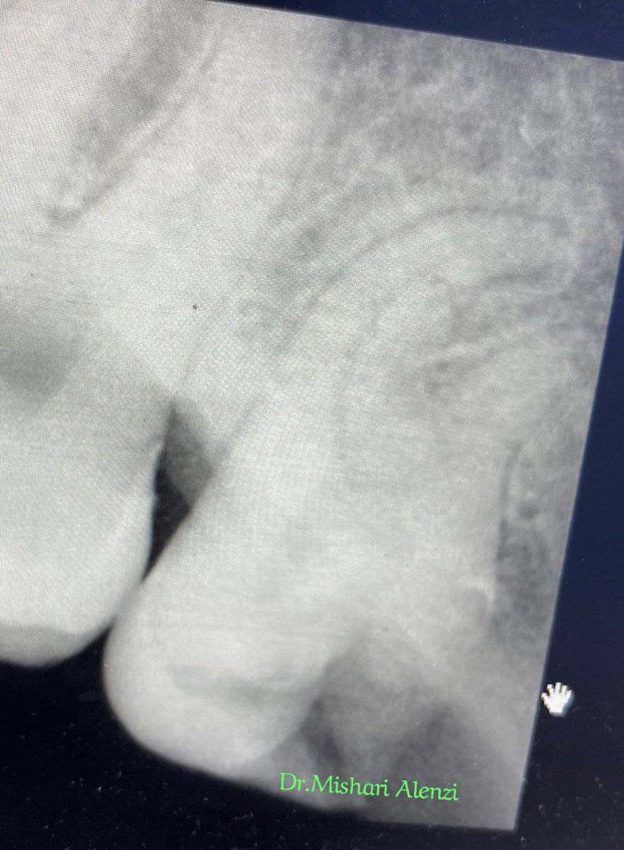 د. مشّاري tweet media