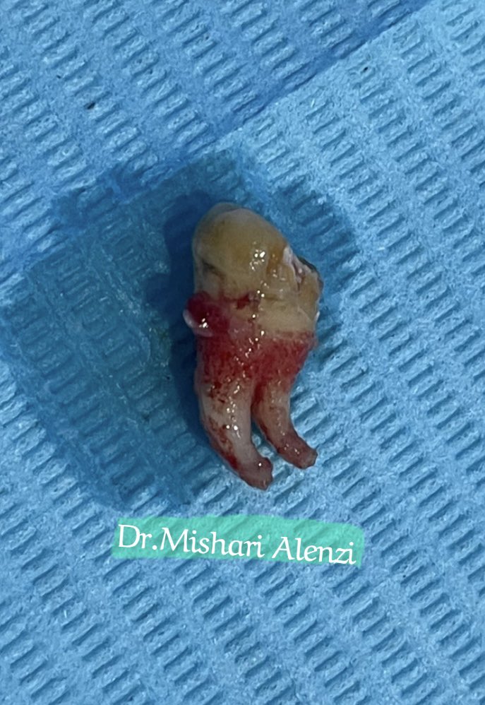 د. مشّاري tweet media