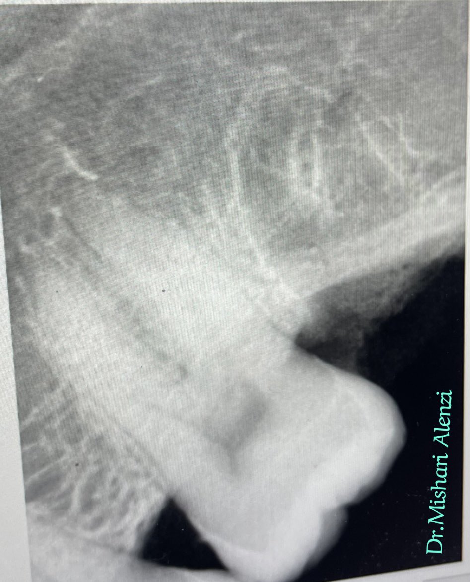 د. مشّاري tweet media