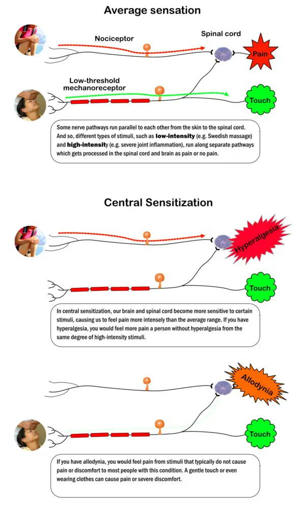 MassageFitMag's tweet photo. A simplified version of what #centralsensitization is &amp; how it works.

Basically CS amplifies signals from stimuli that likely cause pain or major discomfort that normally wouldn't do so for an average population.
#massagetherapy #physicaltherapy #pain

https://t.co/769YlNGaxS https://t.co/Zk5IGhOvpj