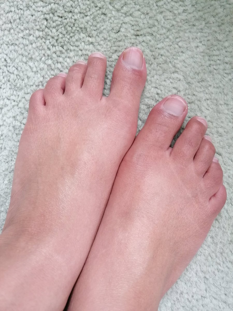 loveft500's tweet photo. This is the beginning. #newsidehustle #feet.
Come and hang out
https://t.co/mXfsfu2eP0 https://t.co/nYE3jTPvPp