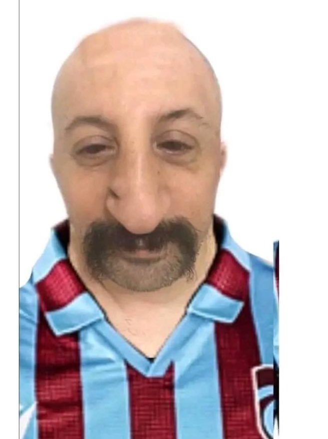 لمن ابوك يكون م عندو جلحة ولا صلعة عشان تورثها 

خالك :