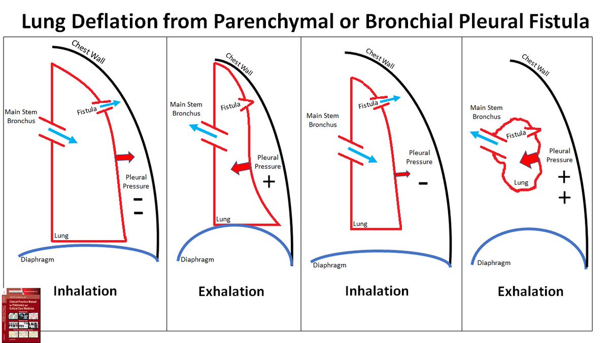 𝗥𝗲𝘀𝘂𝘀𝗠𝗲𝗱 on Twitter "RT LandsbergManual PTX Managment. After