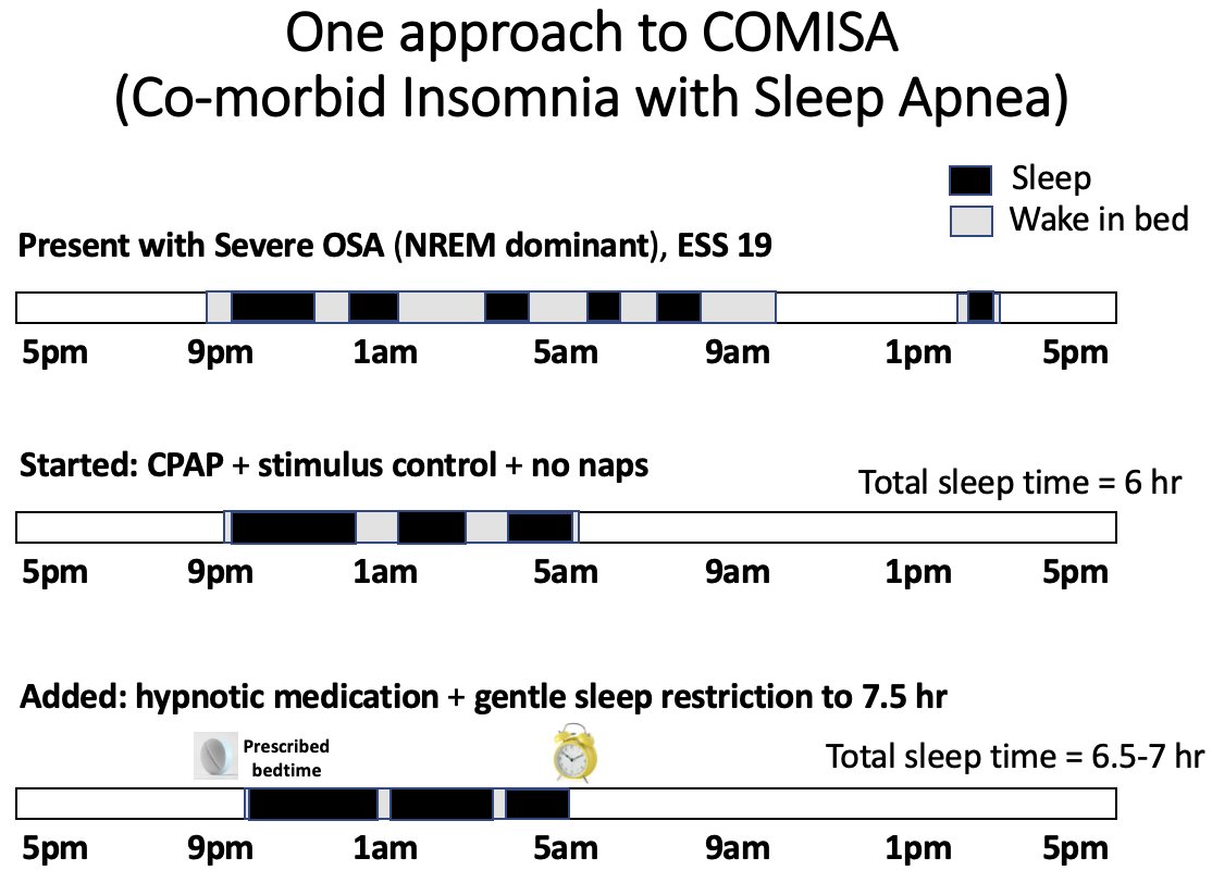 Female in 60s, Hx of minor stroke, BMI 21, presenting with insomnia + excessive daytime sleepiness, ESS 19. PSG: severe NREM dominant OSA, AHI 37 (NREM 39, REM 5). 1st started CPAP + stimulus control + no napping. Then added gentle sleep restriction + hypnotic medication. #COMISA