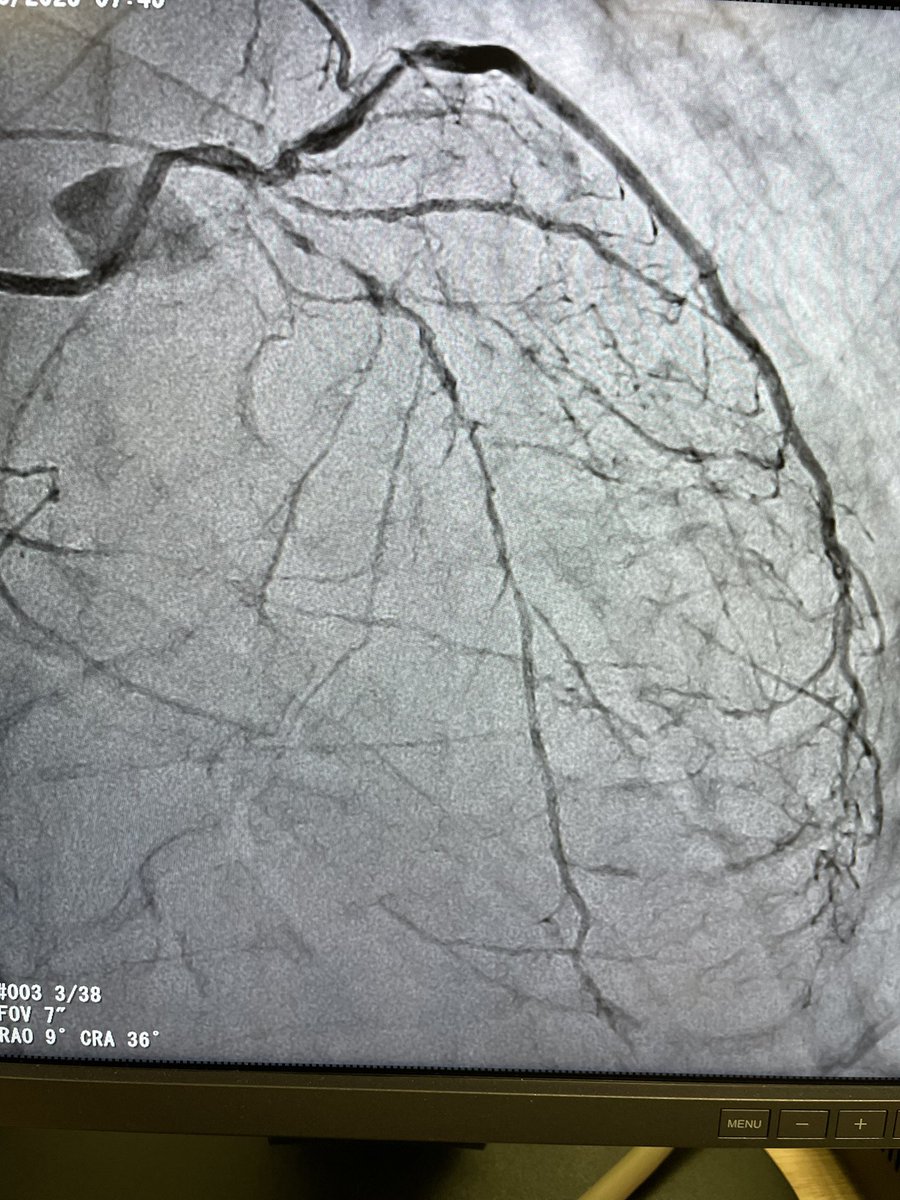 Rodrigo V. Wainstein, MD, PhD tweet media