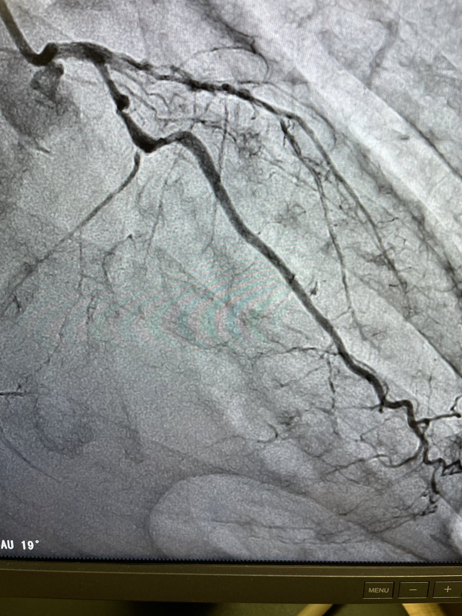 Rodrigo V. Wainstein, MD, PhD tweet media