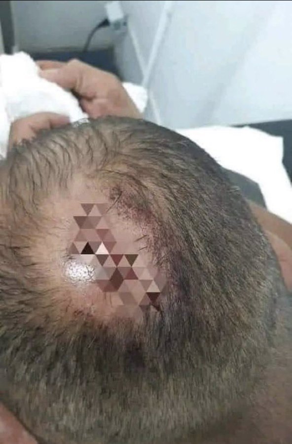 زوجه ضربت زوجها بقدر الطبخ Fsqbaq8XsAEU32x?form