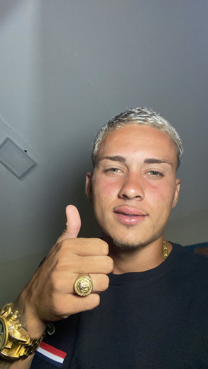 Feinho de rosto 😅🥰