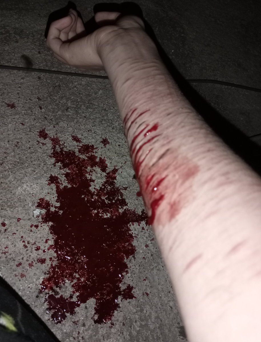 orl_org's tweet photo. q jodido se ve, pero al menos pude hacer varios cortes, el q sigue del styro
mi cuerpo se esta adaptando a ese tipo d cortes https://t.co/MLDv3bPRkv