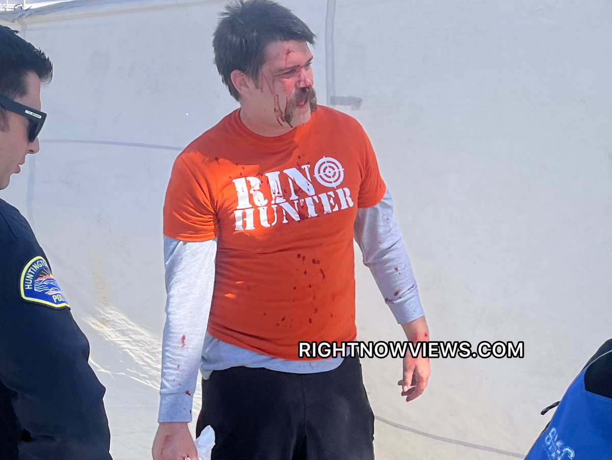 Right_Now_Views's tweet image. Trump supporter Nick Taurus was hit over the head with a skateboard in Huntington Beach and taken away by ambulance. Two were arrested at the scene. #Indictment #Trump2024 #TrumpIndictment #DonaldTrump #Maga2024 #maga #huntingtonbeach #trumprally #OrangeCounty