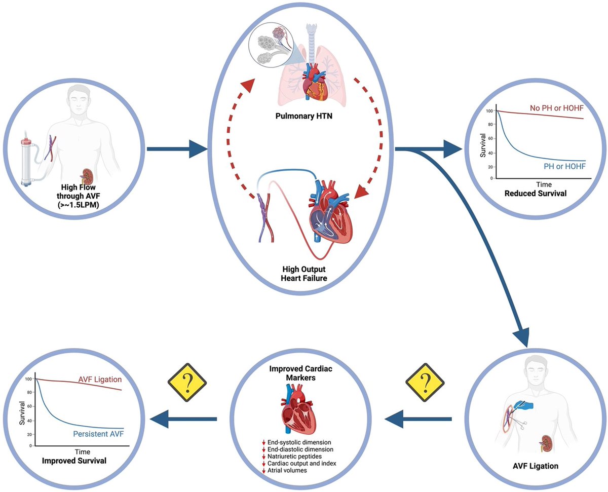 Yevgeniy Brailovsky DO MSc FACC (@yevgeniybr) on Twitter photo Great job <a href="/ewarnermd/">ewarnermd</a> for leading the effort!
We highlight importance of early recognition and management of HOHF and PH after the creation of AVF
Are we missing an opportunity to reverse course?
A call to action to raise awareness.
@JeffIMchiefs <a href="/TJHeartFellows/">Jefferson Cardiology Fellows</a> <a href="/JCardFail/">Journal of Cardiac Failure</a> Great job <a href="/ewarnermd/">ewarnermd</a> for leading the effort!
We highlight importance of early recognition and management of HOHF and PH after the creation of AVF
Are we missing an opportunity to reverse course?
A call to action to raise awareness.
@JeffIMchiefs <a href="/TJHeartFellows/">Jefferson Cardiology Fellows</a> <a href="/JCardFail/">Journal of Cardiac Failure</a>