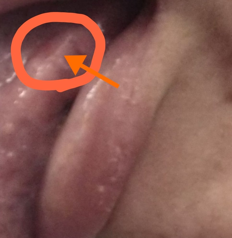 NozomiN9999's tweet image. 私は被害や受けたネガティブに対し許容の問題か1度ではactionしない事が多い。舌は前回と同箇所を殺ってきた先ほど。ハエのフルネームを把握して、常識ある方々。目視にて舌内部でうっすら血がにじんでいる事が認められたが添付で分かるか。

#集団ストーカー 
#ElectromagneticWave