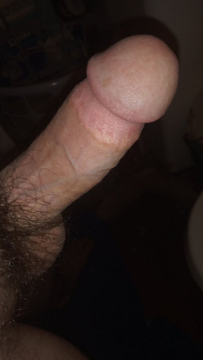 tublanquito18's tweet photo. Les gusta amores ? #rt #chathot #tulon #scort #chile #caliente #pico #packdefamosos #packxpack https://t.co/9uOvXId0Sh